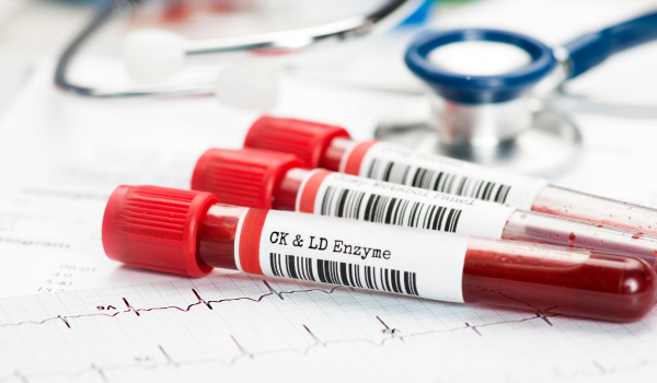 Creatine Kinase and Its Testing
