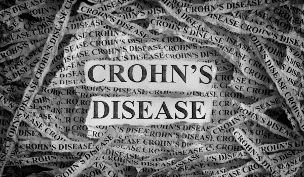 My First Signs of Crohn's Disease Weren't Digestion-Related: What To Look Out For