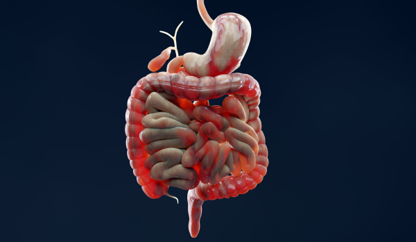 Getting the Crohn's Disease Support You Need