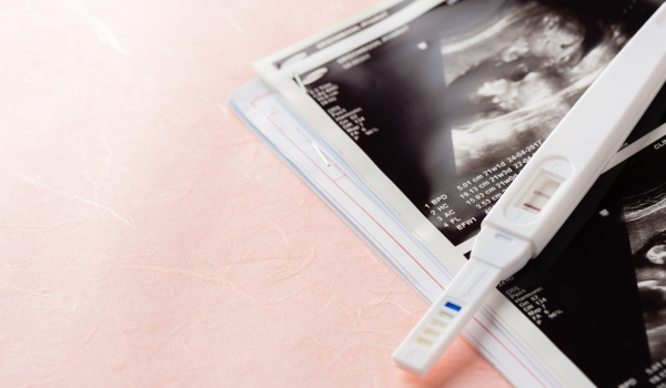 When Should You Take a Pregnancy Test After Unprotected Sex