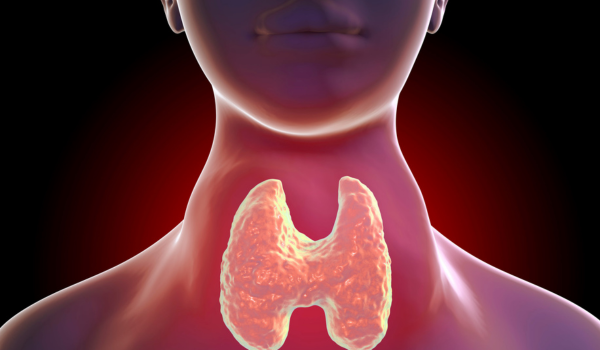 Living With Graves' Disease—A Disease That Makes My Thyroid Go Haywire