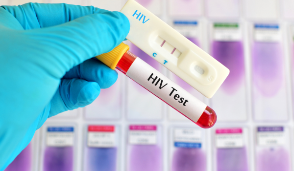 Getting A Human Immunodeficiency Virus (HIV) Diagnosis