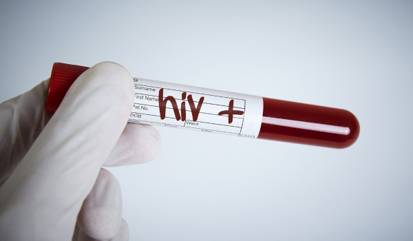 What Is Human Immunodeficiency Virus (HIV)?