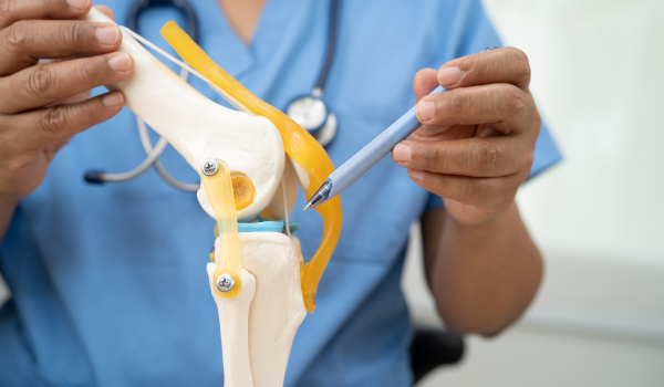 What To Know About Tricompartmental Osteoarthritis
