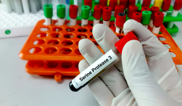 What Is Protease and How Important Is It?