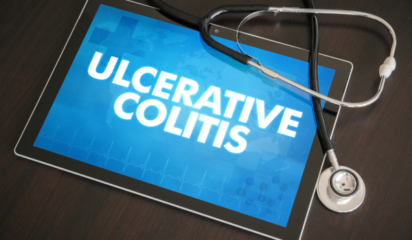 How Is Ulcerative Colitis Diagnosed?