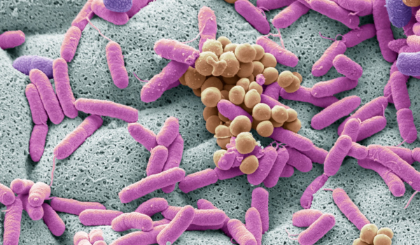 What Is Listeria and How It Can Affect Your Health