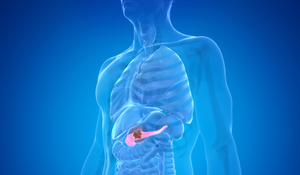 Why Is Pancreatic Cancer So Deadly?