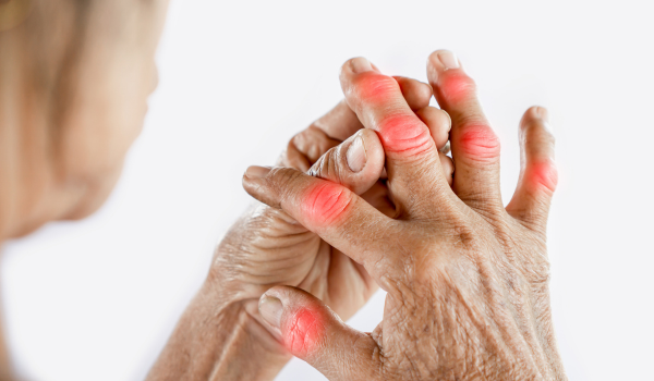 Key Signs And Symptoms Of Arthritis And How To Recognize Them