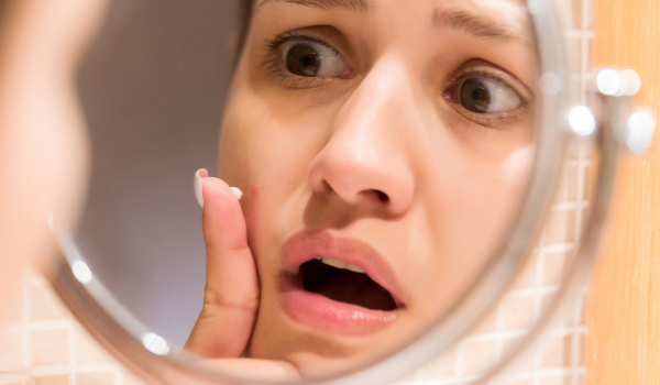 Effective Ways To Treat And Prevent Pimples On The Lips