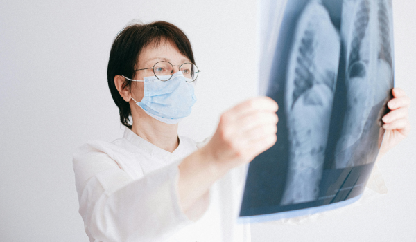 Understanding Lung Cancer in Younger and Middle-Aged Women