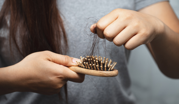 Signs and Symptoms of Alopecia: An In-Depth Overview