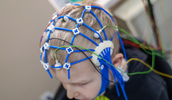 How Is Epilepsy Treated?