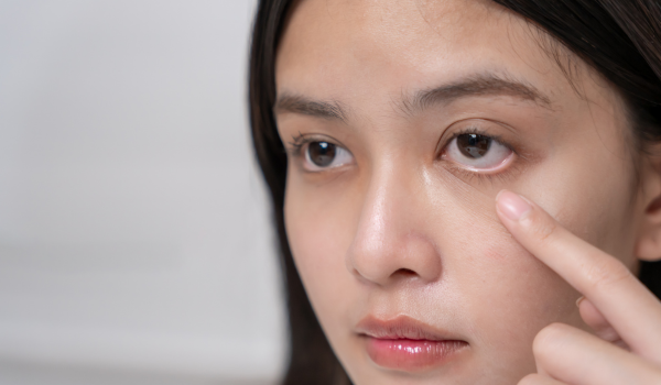 How To Tell If a Contact Lens Is Still in Your Eye