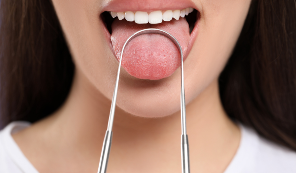 Why Do You Have A Yellow Tongue