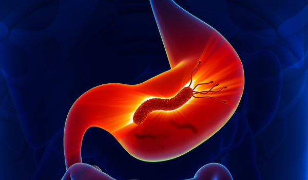 Signs and Symptoms of an H. Pylori Infection