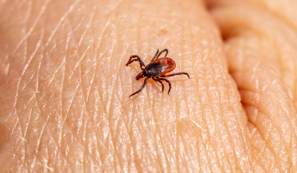 What Causes Lyme Disease and Can You Get It Twice?