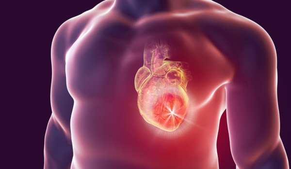 What Is Cardiac Arrest?