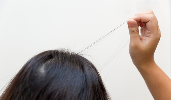 What You Need to Know About Trichotillomania and Its Impact on Mental Health