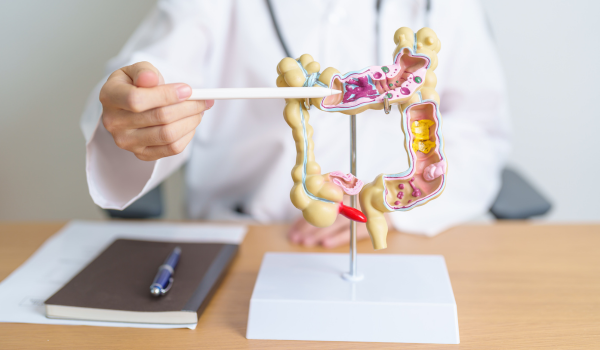 How Is Diverticulitis Treated?
