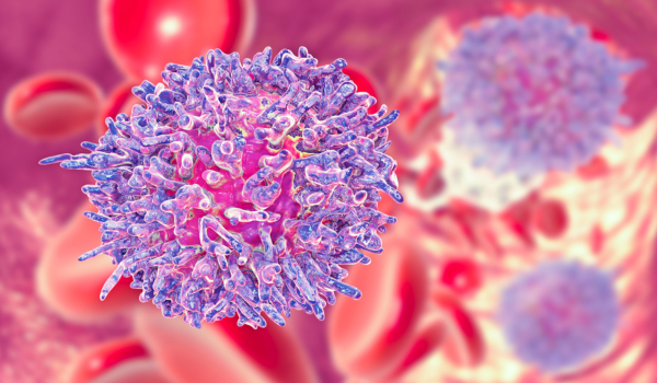How Is Leukemia Diagnosed?