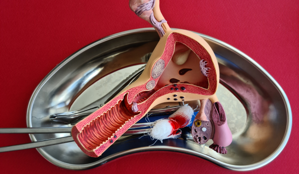 Ovarian Cancer Prevention: Should You Consider Getting Your Fallopian Tubes Removed?