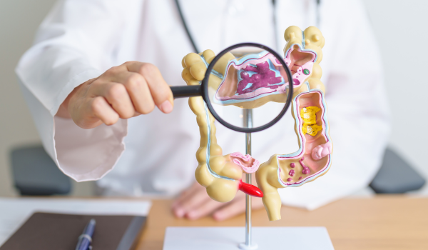 What You Need To Know About Ulcerative Colitis Stool