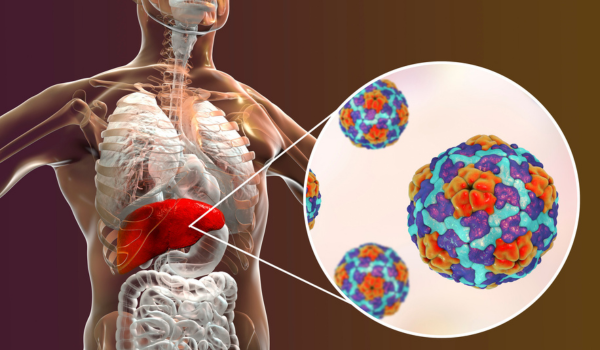Hepatitis Causes: Everything You Need to Know