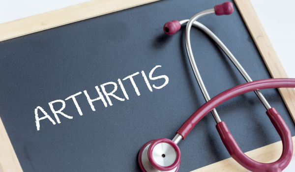 Top 4 Causes of Arthritis and the Things That Increase Your Risk