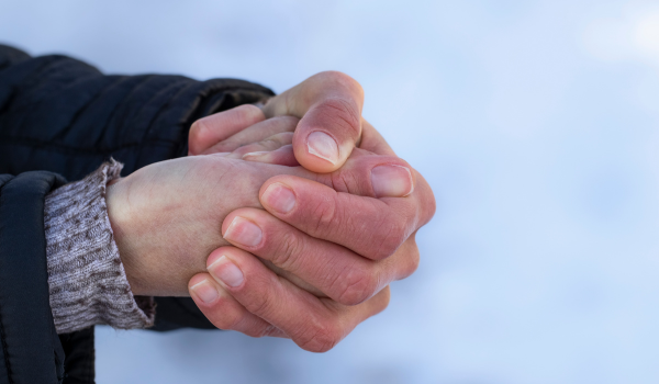 Frostbite First Aid: How to Recognize and Treat Cold-Related Skin Damage