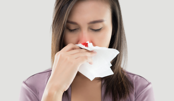 Nosebleeds first aid: how to stop bleeding and prevent recurrence