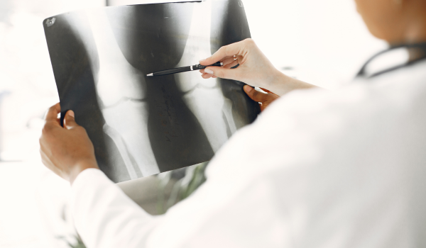 How Bone Marrow Cancer Is Diagnosed: Tests and Screening Methods