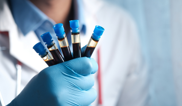 How Blood Cancer Is Diagnosed: Tests and Procedures