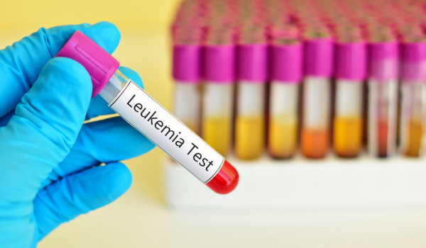 How Is Leukemia Diagnosed? Tests and Screening Methods Explained