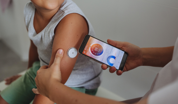 Advances in Technology for Type 1 Diabetes: From CGMs to Artificial Pancreas