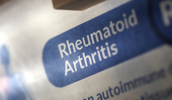 Genetic and Environmental Factors Behind Rheumatoid Arthritis