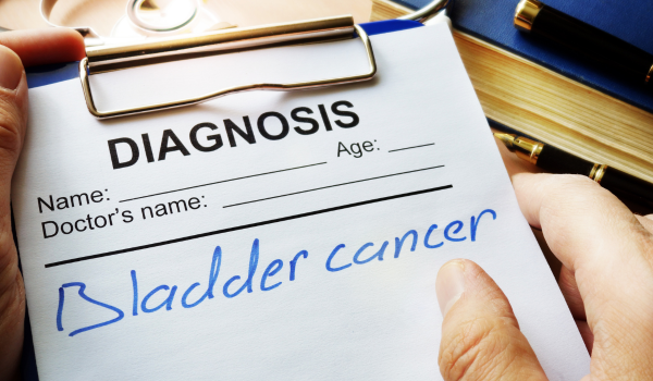 What Causes Bladder Cancer? Understanding the Main Risk Factors