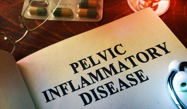 Common Causes of Pelvic Inflammatory Disease in Women