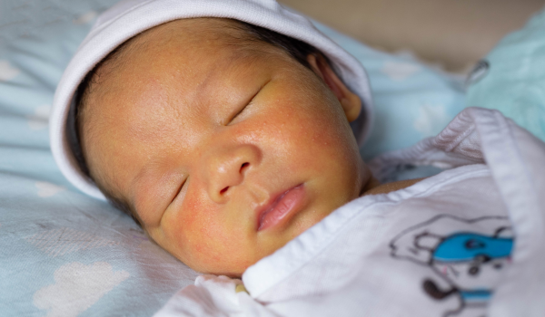Types of Jaundice: Pre-Hepatic, Hepatic, and Post-Hepatic