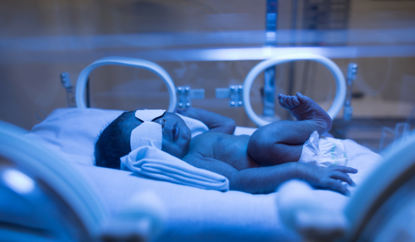 Jaundice in Newborns: Causes, Risks, and Treatments
