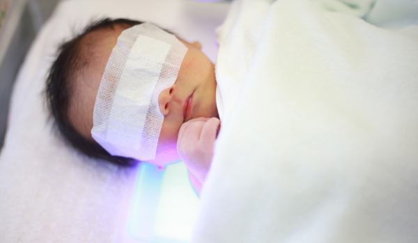 Liver Diseases Linked to Jaundice: Hepatitis, Cirrhosis, and More