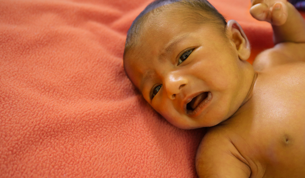 Prevention of Jaundice: Healthy Habits and Early Detection Tips
