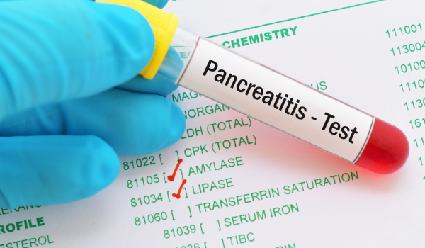 Potential Complications of Pancreatitis and How to Prevent Them
