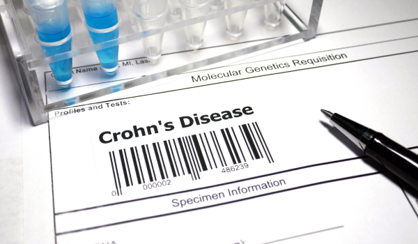 Current Treatment Options for Crohn’s Disease: From Medications to Biologics