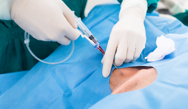 Complications of Untreated May-Thurner Syndrome: What You Need to Know