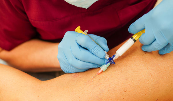 How May-Thurner Syndrome Relates to Chronic Venous Insufficiency