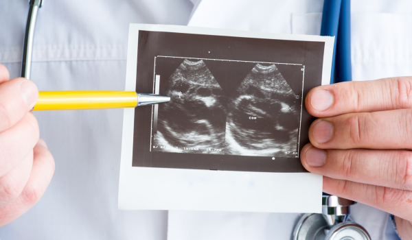 Common Causes of Pericarditis: What Triggers Inflammation of the Heart Lining?