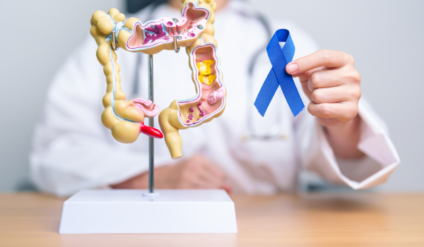 The Link Between Ulcerative Colitis and Colon Cancer