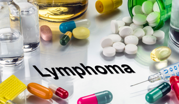 Lymphoma: A Comprehensive Guide to Lymphatic System Cancer
