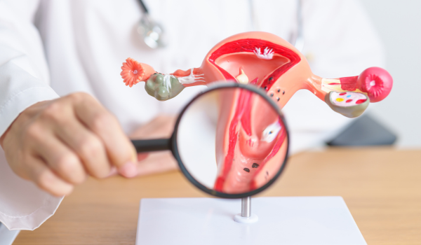 How Uterine Cancer Is Diagnosed: Tests and Examinations Explained